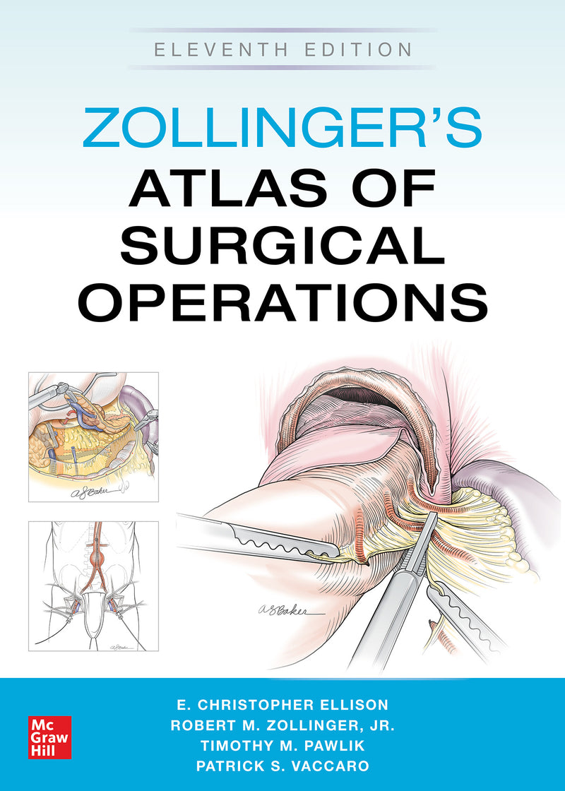 Zollingers Atlas Of Surgical Operations Eleventh Edition