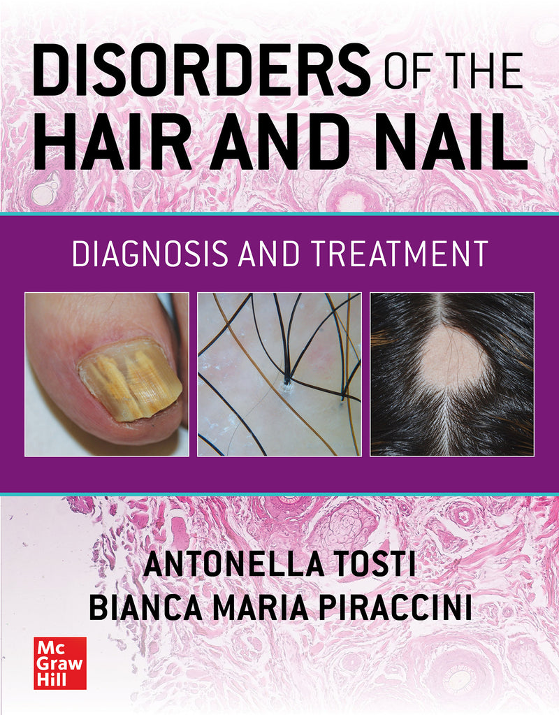 Disorders Of The Hair & Nail Diagnosis & Treatment
