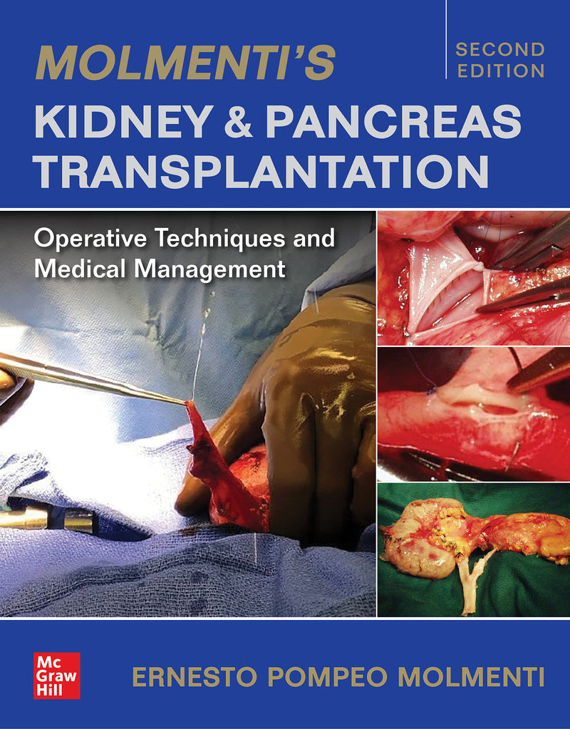 Molmentis Kidney & Pancreas Transplantation Operative Techniques & Medical Management 2e