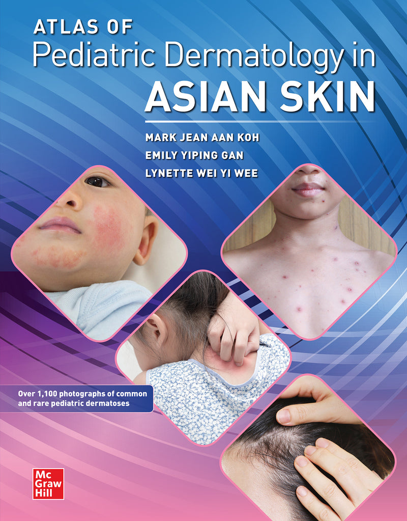 Atlas Of Pediatric Dermatology In Asian Skin
