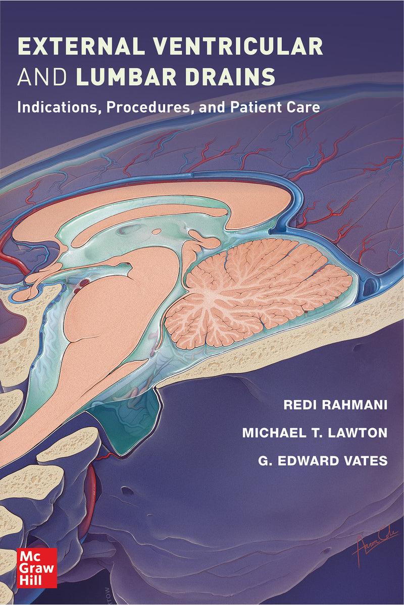 External Ventricular & Lumbar Drains Indications Procedures & Patient Care