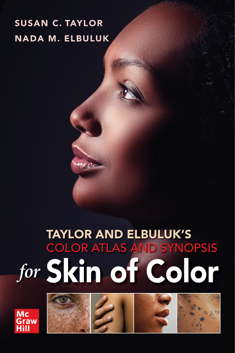 Taylor & Elbuluks Color Atlas & Synopsis For Skin Of Color