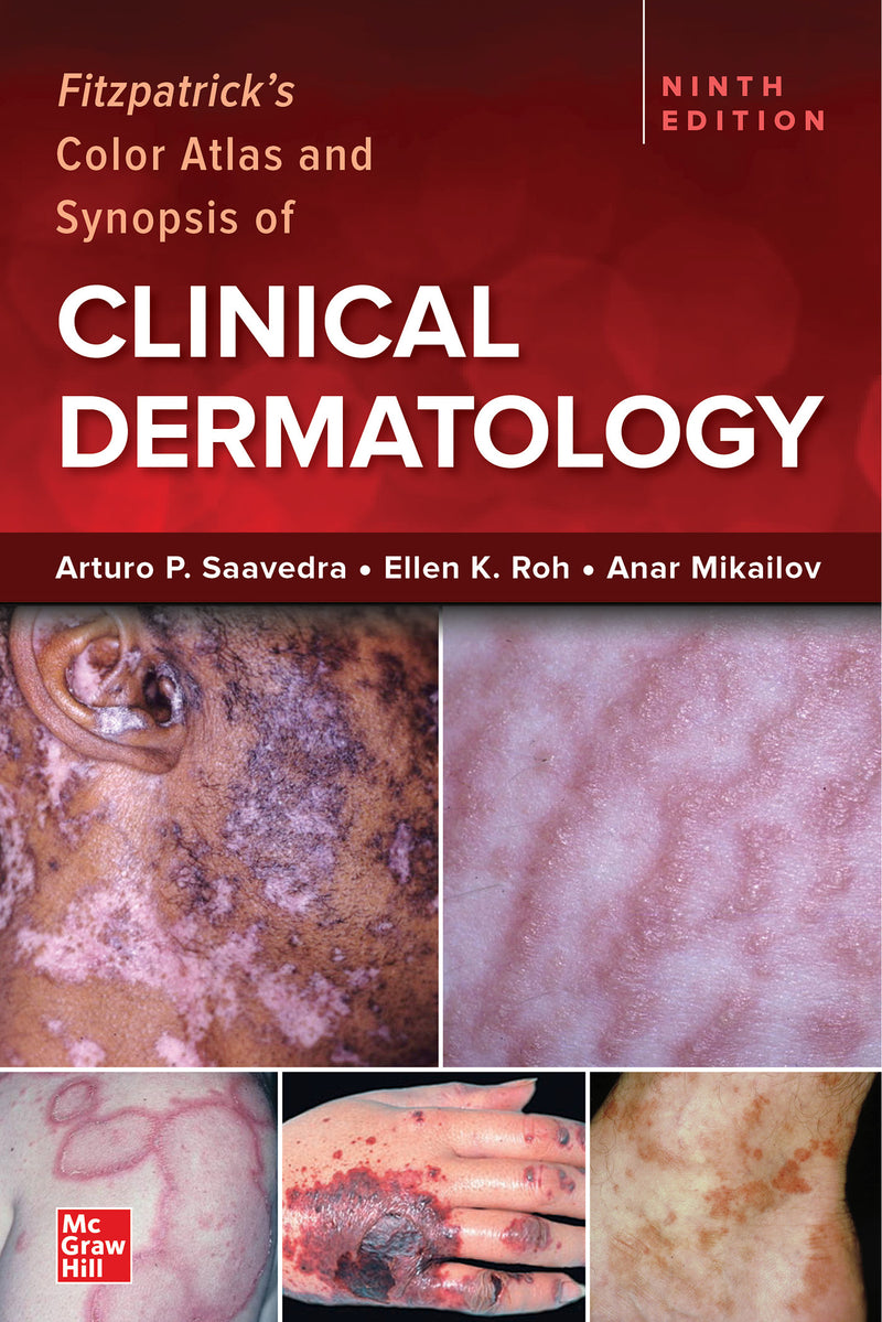 Fitzpatricks Color Atlas & Synopsis Of Clinical Dermatology Ninth Edition 9e