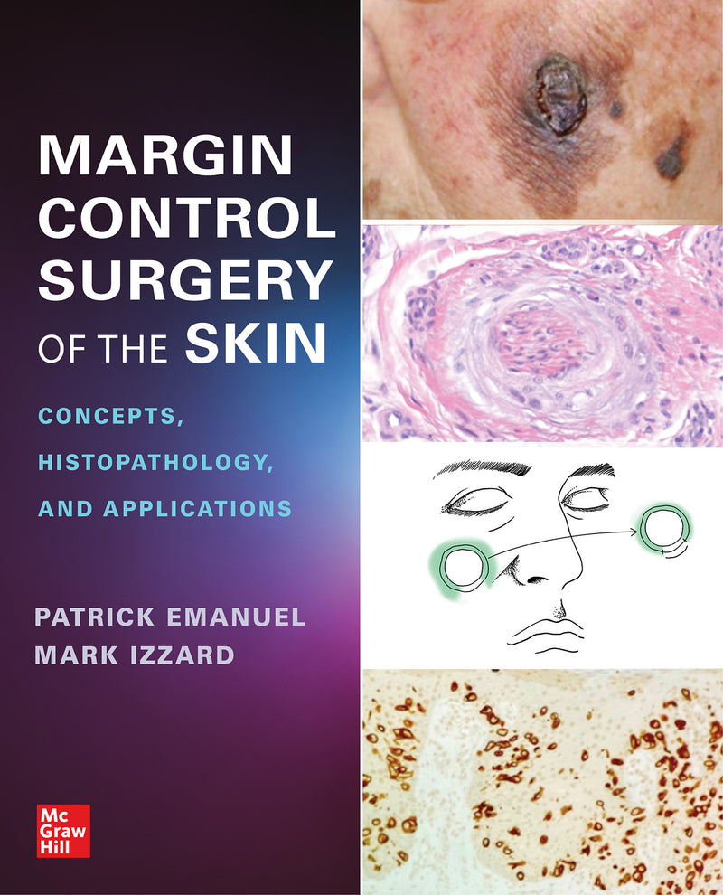 Margin Control Surgery Of The Skin Concepts Histopathology & Applications