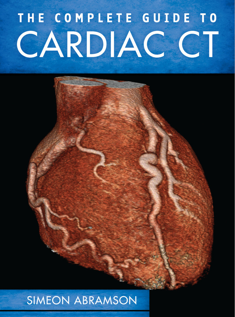 The Complete Guide To Cardiac Ct Pb