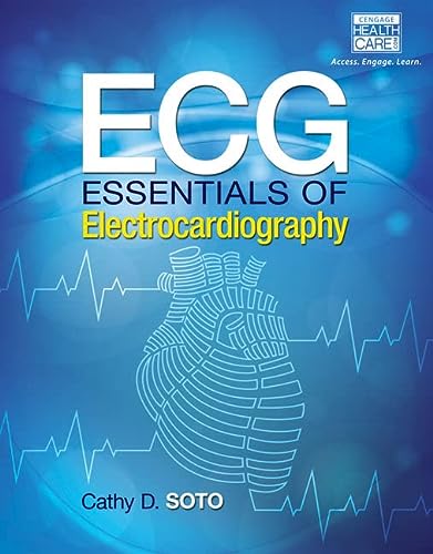ECG