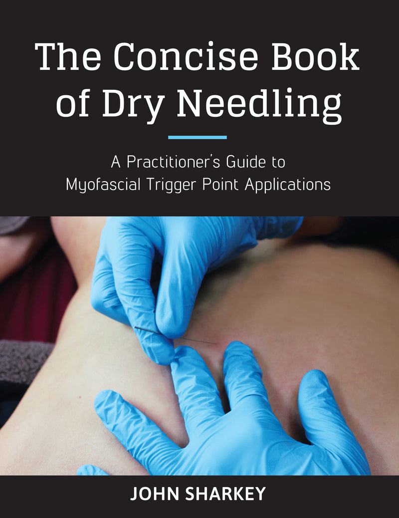 The Concise Book of Dry Needling
