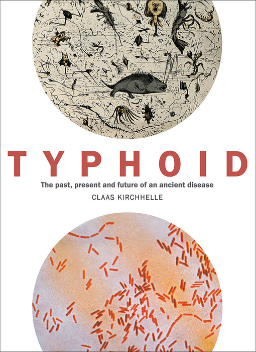 Typhoid