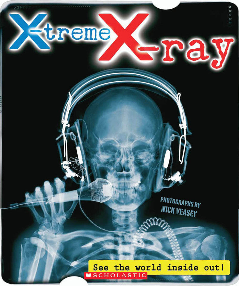 X-treme X-ray: See the World Inside Out!