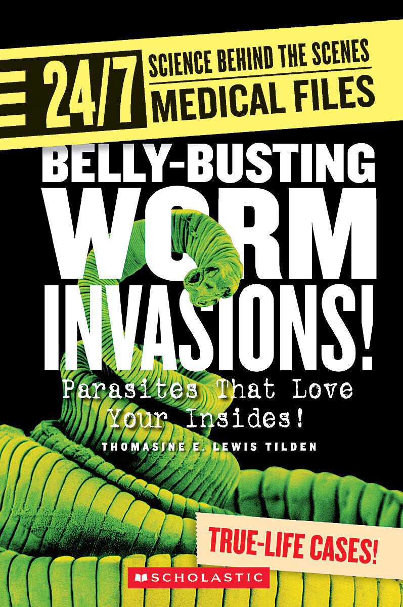 Belly-busting Worm Invasions! (24/7: Science Behind the Scenes: Medical Files)