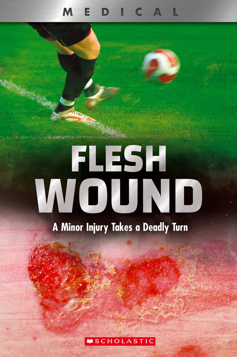 Flesh Wound: A Minor Injury Takes a Deadly Turn (XBooks)