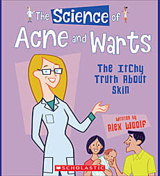 The Science of Acne and Warts: The Itchy Truth About Skin (The Science of the Body)